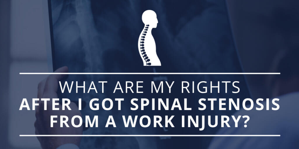 What Are My Rights After I Got Spinal Stenosis from a Work Injury?